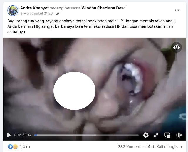 [Cek Fakta] Video Anak Terinfeksi Radiasi karena Sering Bermain <i>Handphone</i> ? Begini Faktanya