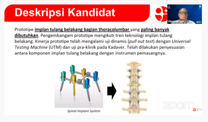 Implan Tulang Belakang Hasil Riset BRIN Bakal Diuji Klinis