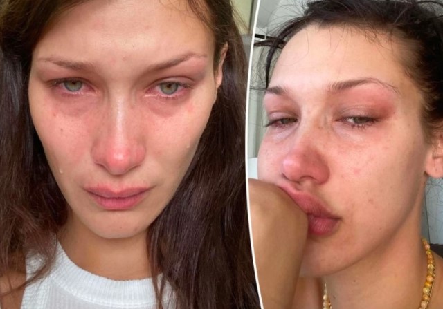 Bella Hadid akui ia sempat mengalami gangguan kecemasan. (Foto: Dok. Instagram Bella Hadid/Pagesix.com)