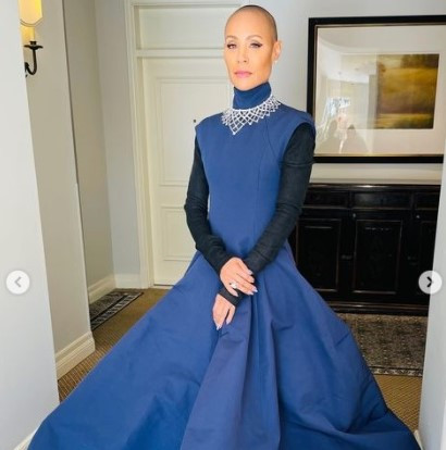 Jada Pinkett Smith menderita alopecia. Instagram jadapinkettsmith