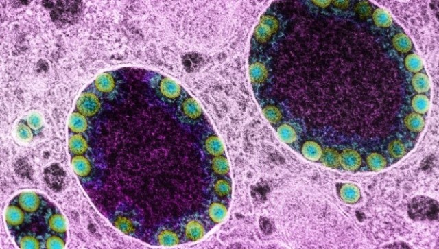 Ini varian terbaru dari omicron, yaitu omicron XE. (Foto: Dok. Deadline.com)