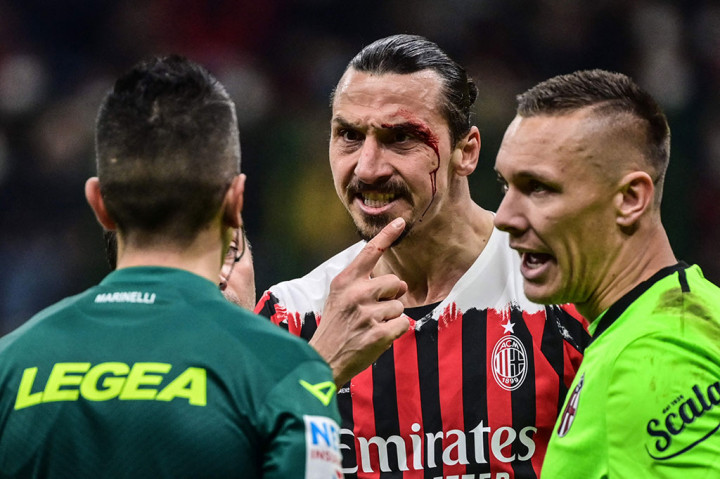 Potret Zlatan Ibrahimovic Berdarah-darah pada Laga Milan Vs Bologna