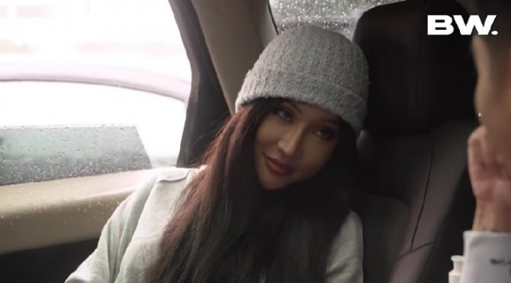 Mengenal Oplas 'Ganti Kepala' yang Dilakukan Lucinta Luna