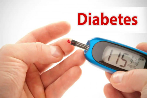 Mulai Deteksi Dini Diabetes di Usia 30-an (Foto: gettyimages)