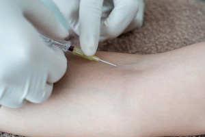 Pada Usia Berapa Sebaiknya Melakukan Vaksinasi HPV?