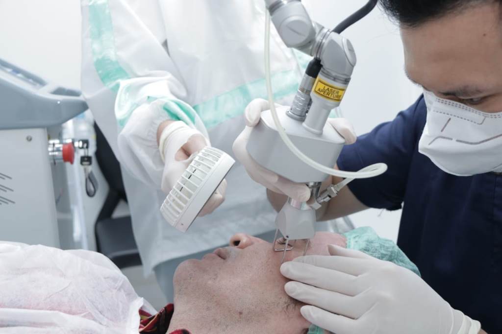 Proses SmartXide Touch dot laser (Foto: Dremaster Clinic.)