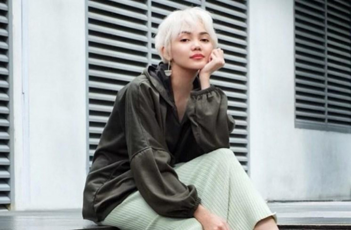Rina Nose Akui Alami Gangguan Mental, Sempat Jadi Pemicu Perceraian