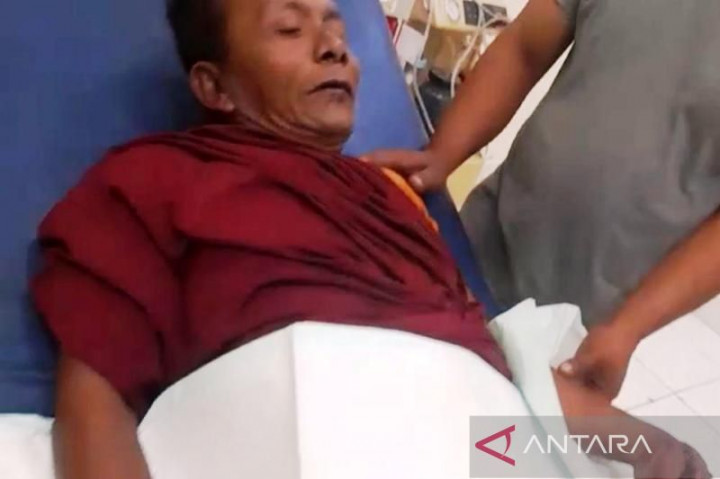 Petasan Meledak Hebat di Tangan Warga, Polisi Lakukan Penyelidikan