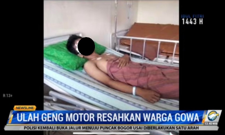 MP, 17, terkena anak panah di bagian dahi tepat di atas mata kanan dan C, 14, terkena panah di tangan kanan. Metro TV