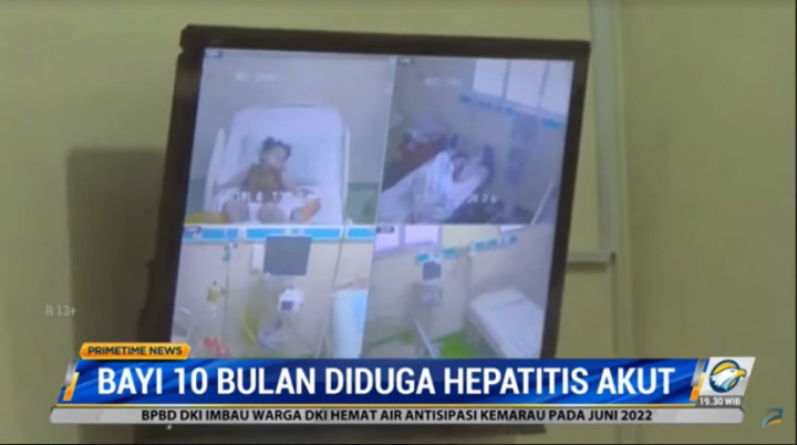 Bayi 10 Bulan di Jawa Timur Diduga Idap Hepatitis Akut