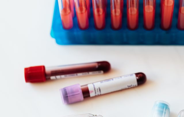 Hindari Talasemia, Deteksi Sedari Dini