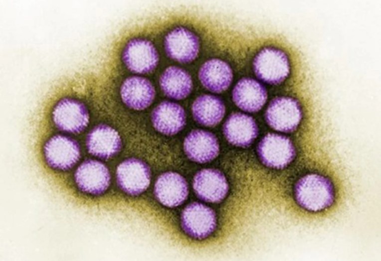 Ini rupa dan sepak terjang dari Adenovirus 41 si enyebab Hepatitis misterius. (Foto: Dok. CDC)