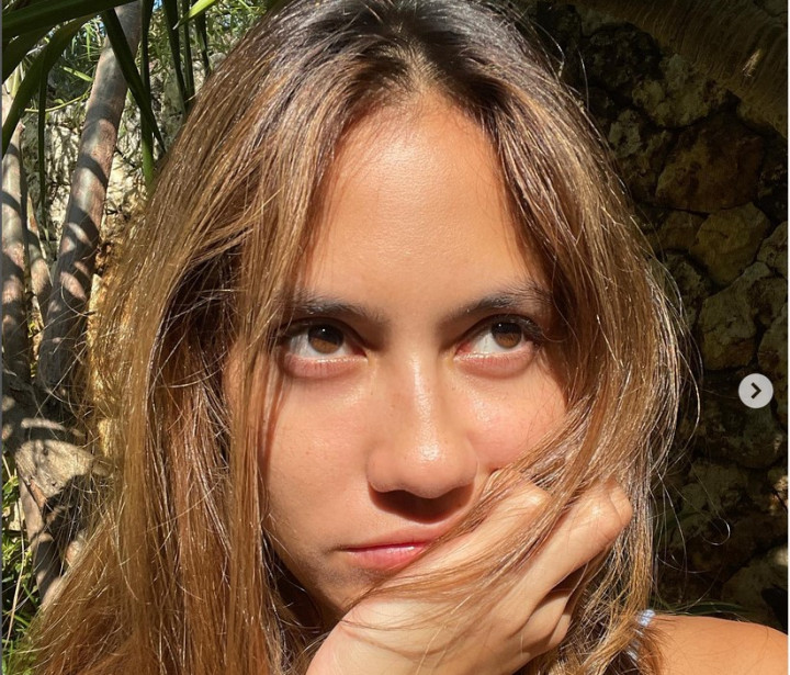 Dialami Pevita Pearce, Ini Penyebab dan Cara Mudah Obati Sariawan