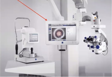 Teknologi Callisto Eye (Foto: JEC)