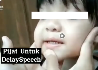 [Cek Fakta] Memijat Bagian Muka dan Telinga pada Anak Dapat Mengatasi <i>Speech</i> <i>Delay</i> ? Cek Dulu Faktanya
