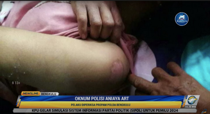 Oknum Polisi di Bengkulu Aniaya ART