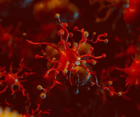 Lansia Rentan Alami Kanker Darah, Kenali Gejala dan Pencegahannya