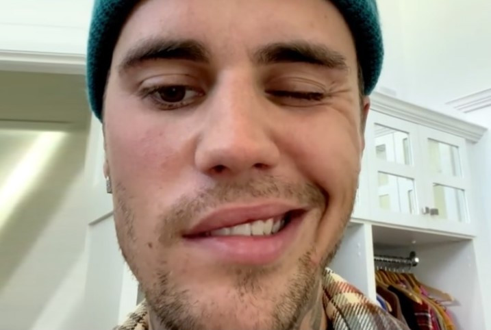 ?Justin Bieber mengalami Ramsay Hunt Syndrome. Instagram justinbieber
