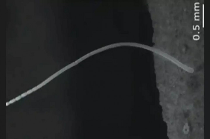 Ilmuwan Temukan Bakteri Terbesar di Dunia saat Jelajahi Hutan Karibia