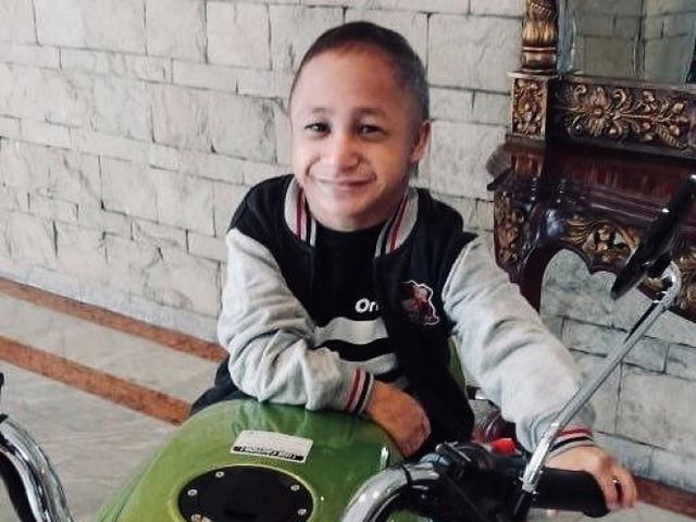 Dicky Topan Meninggal Dunia, Sempat Alami Pembengkakan Jantung