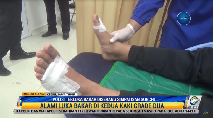 Kapolres Jombang Dirawat Setelah Disiram Air Panas oleh Simpatisan MST