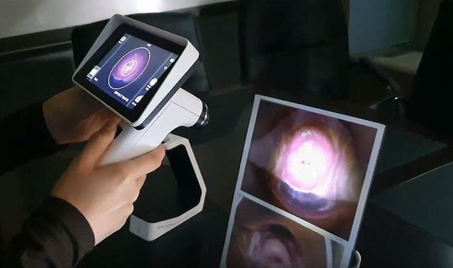 PYFA Hadirkan Perangkat Skrining Kanker Serviks Berbasis AI