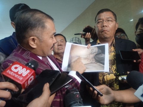 Autopsi Ulang Jenazah Brigadir Yosua, 7 Dokter Forensik Dilibatkan