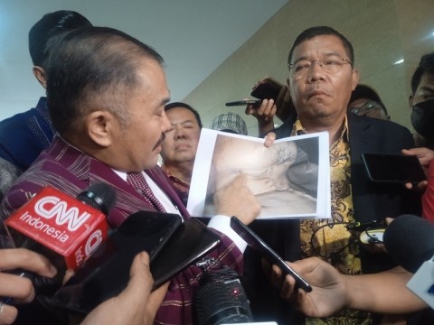 Autopsi Ulang Jenazah Brigadir Yosua, 7 Dokter Forensik Dilibatkan Autopsi Ulang Jenazah Brigadir Yosua, 7 Dokter Forensik Dilibatkan