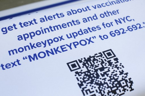 The Ministry of Health Makes Sure There Are No Cases of Monkeypox in Indonesia