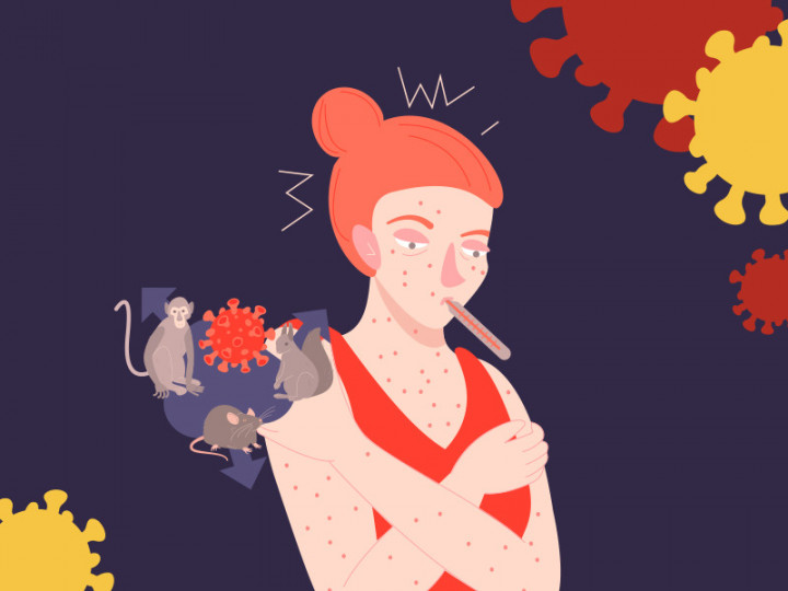 4 Fakta Mengenai Kasus Pertama Cacar Monyet di Indonesia