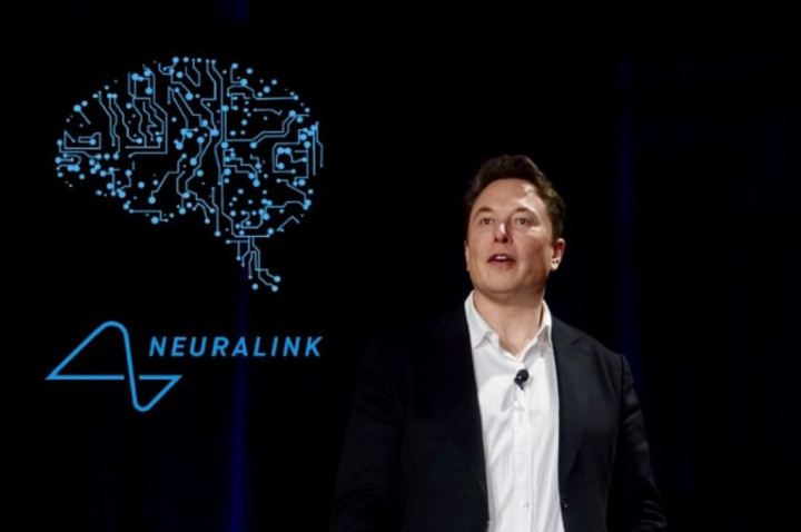 Elon Musk Pertimbangkan Investasi di Perusahaan Pesaing Neuralink