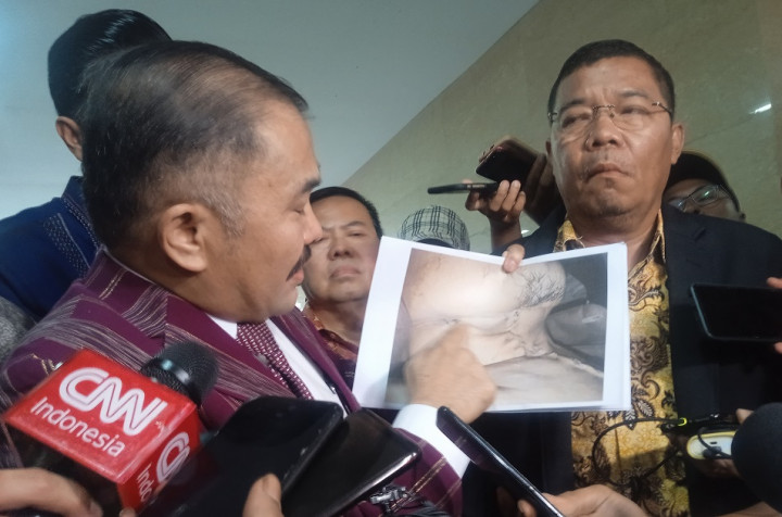 Dituduh Kelola Dana Capres, Dirut Taspen Akan Mengambil Langkah Hukum Dituduh Kelola Dana Capres, Dirut Taspen Akan Mengambil Langkah Hukum