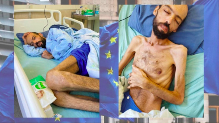 Uni Eropa Terkejut Foto Tahanan Palestina dengan Tubuh Menyisakan Kulit dan Tulang