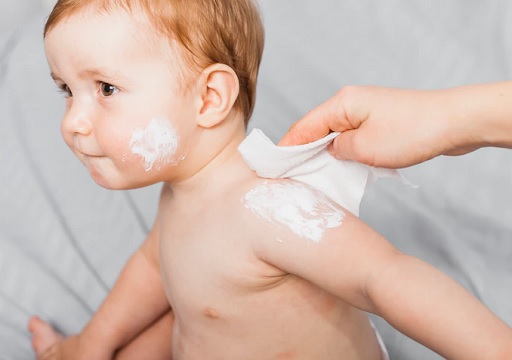 Karena lebih sensitif, orang tua wajib cermat pada setiap produk kulit yang dipakai utuk bayi. (Foto: Ilustrasi. Dok. Freepik.com)