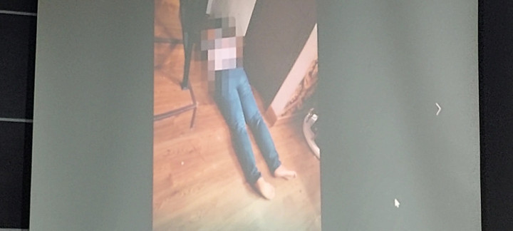 Komnas HAM Ungkap Foto Brigadir J Usai Ditembak