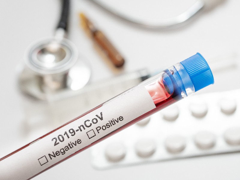 Ilustrasi covid-19/Medcom.id/M Rizal