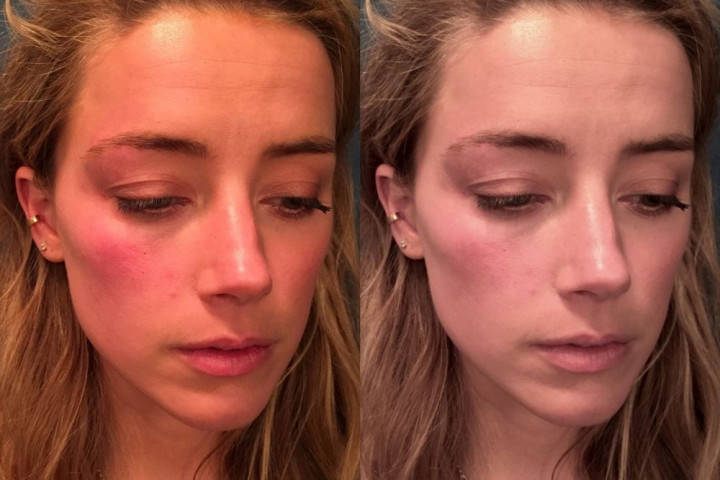 Email Tim Amber Heard Bocor, Bukti Foto Memar di Persidangan Diduga Palsu Email Tim Amber Heard Bocor, Bukti Foto Memar di Persidangan Diduga Palsu
