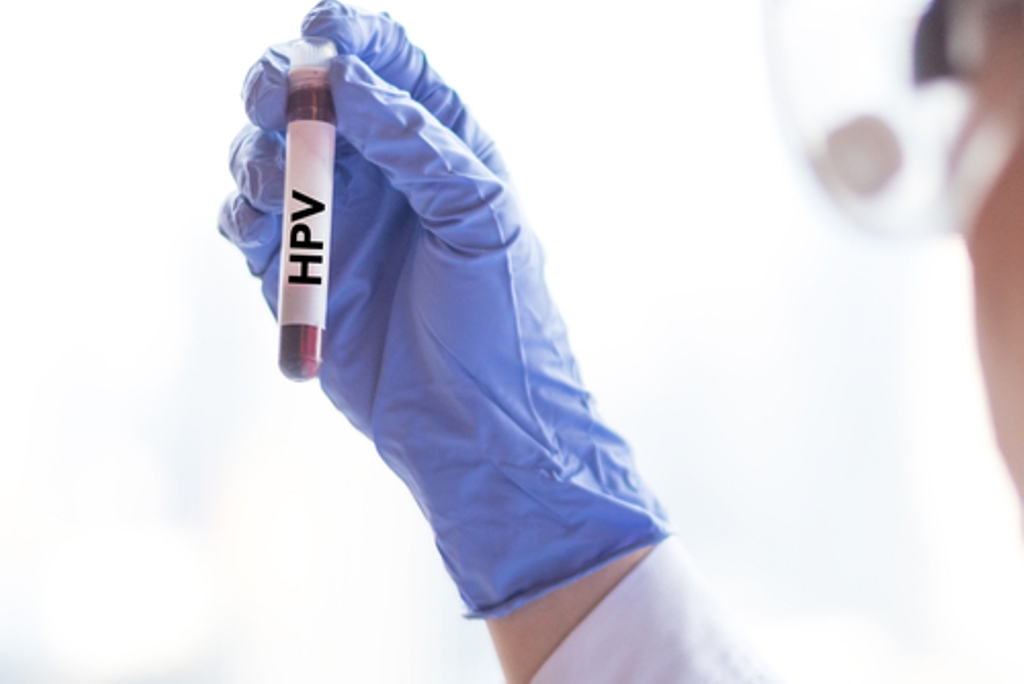 Vaksin HPV (Foto: Unsplash)
