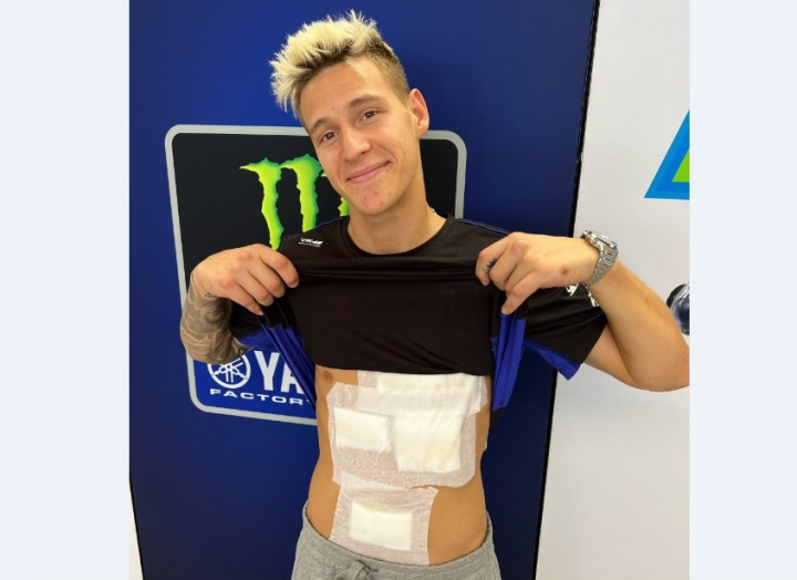 Ngilu! Fabio Quartararo Pamer Tubuh Dipenuhi Perban