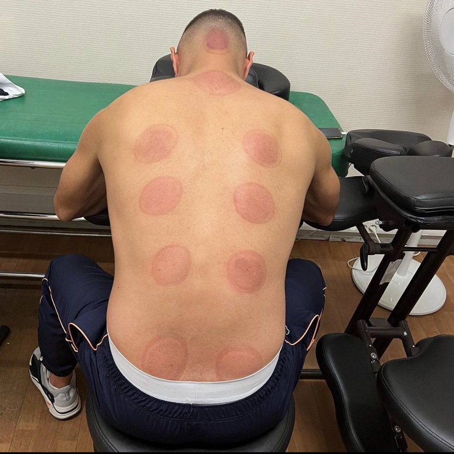 Benzema pamer bekas bekam Twitter @Benzema