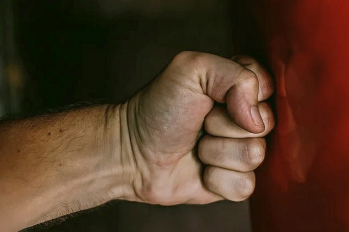 Terbakar Cemburu, Seorang Guru Diduga Dianiaya Oknum Jaksa