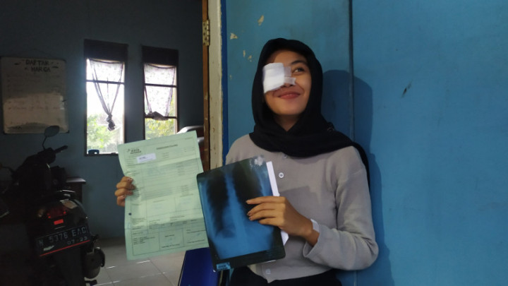 Mata Faiza Masih <i>Gelap</i> Buntut Tragedi Kanjuruhan