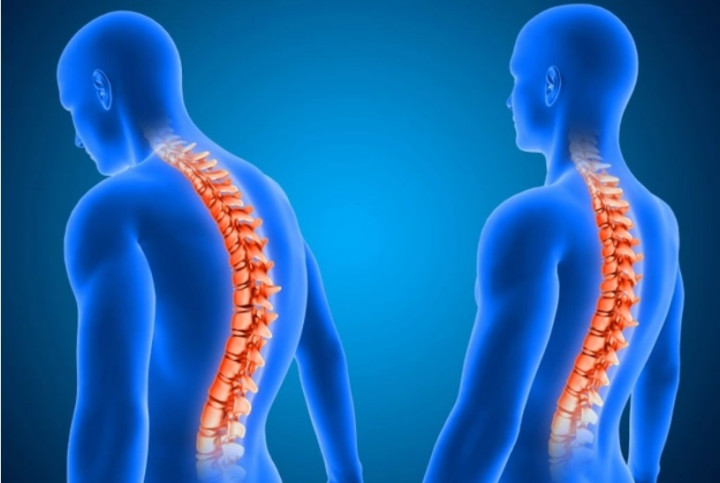 Maknai Hari Osteoporosis Sedunia dengan Mengetahui Cara Pencegahannya