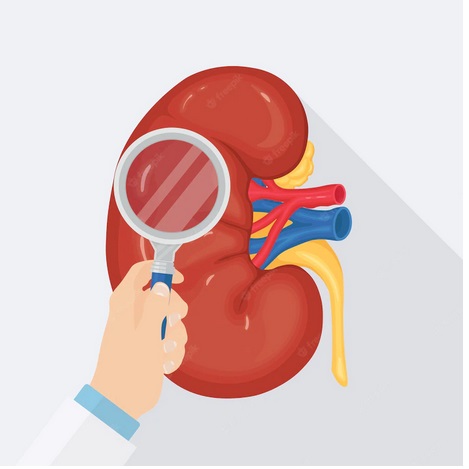 Kasus Gangguan Ginjal Akut Mayoritas Alami Stadium 3, Apa Artinya?