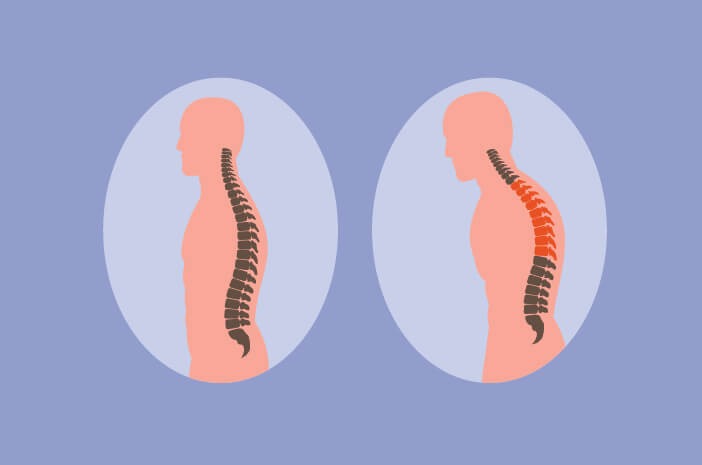 4 Gerakan Hewan Ini Bisa Mengatasi Badan Bungkuk
