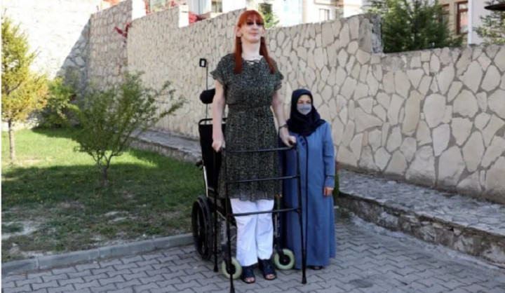 Untuk Pertama Kali, Wanita Tertinggi Dunia Bisa Naiki Pesawat