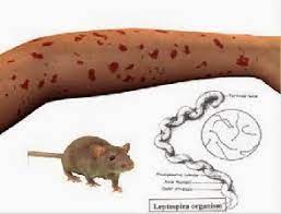 Seorang Warga Tulungagung Meninggal usai Terinfeksi Penyakit Kencing Tikus