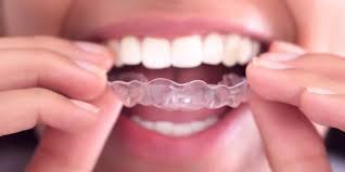 Digugat Pasien Behel Sering Lepas, Tukang Gigi Didakwa Kasus Penipuan