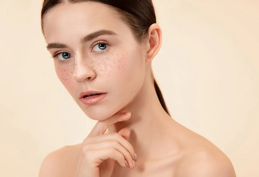 Rosacea kerap menyebabkan wajah jadi kemerahan. (Foto: Ilustrasi. Dok. Freepik.com)