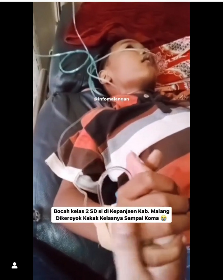 Bocah Korban Perundungan di Malang Diseret Hingga Ditendang Kepalanya